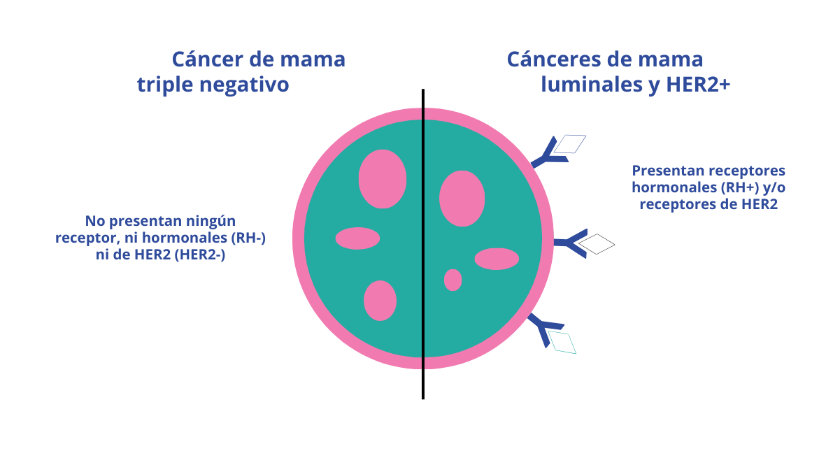 Infografía que explica la diferencia entre los cánceres de mama luminales y HER2+ y el triple negativo