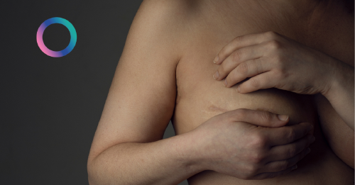 cancer_mama_metastasico cancer_mama_metastasico