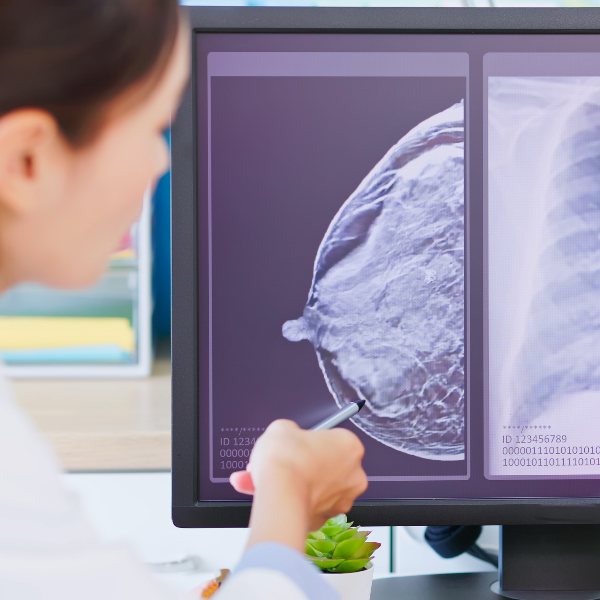 Una doctora examina una placa de mamografía