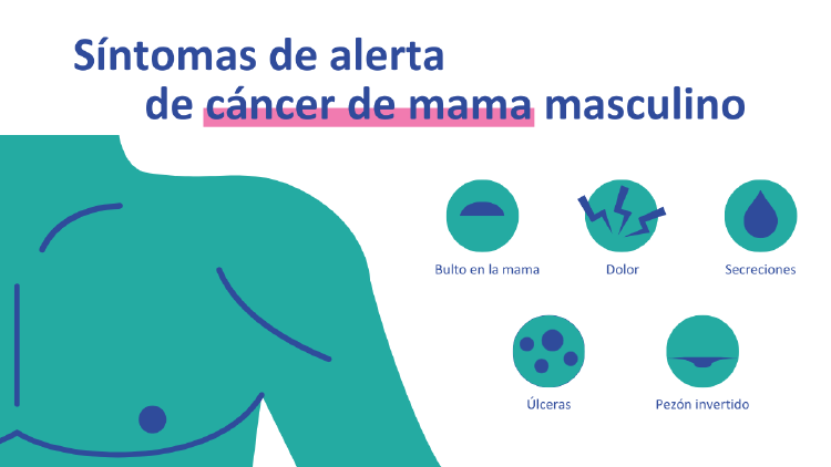 Cáncer mama masculino síntomas Infografía de los síntomas del cáncer de mama masculino